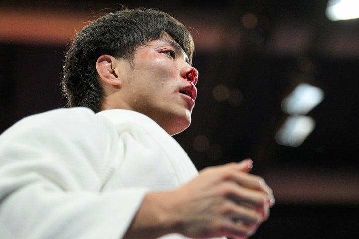 阿部は準々決勝で２度の鼻血。「棄権負け」の危機的状況だった。(C) Getty Images