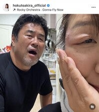 目が突然腫れて病院を受診したという北斗さん（右）。（画像は北斗晶さんの公式インスタグラムより）
