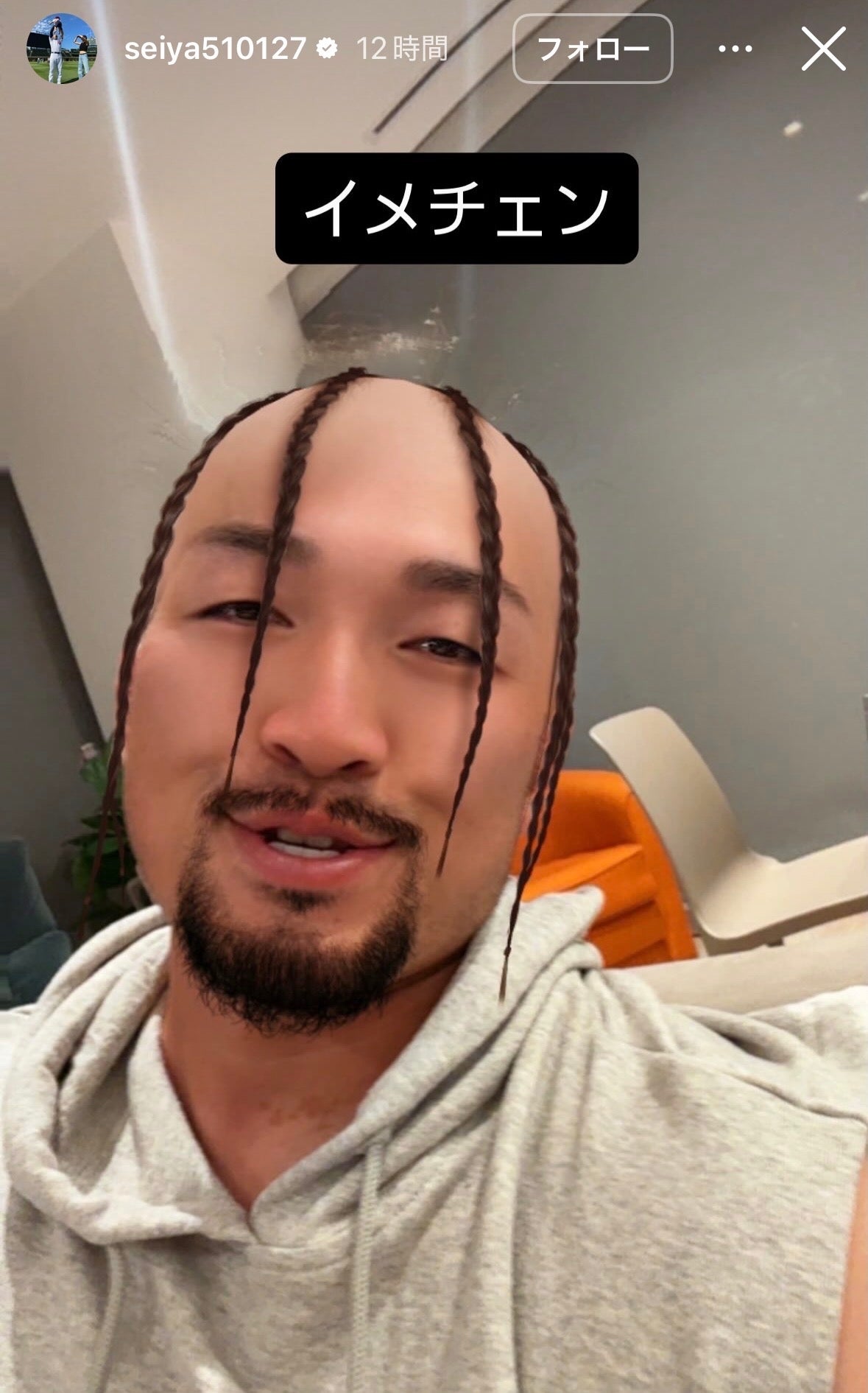 鈴木誠也の衝撃のコーンロウ風ショット。写真：本人のインスタグラムのストーリーズ（＠　seiya510127）